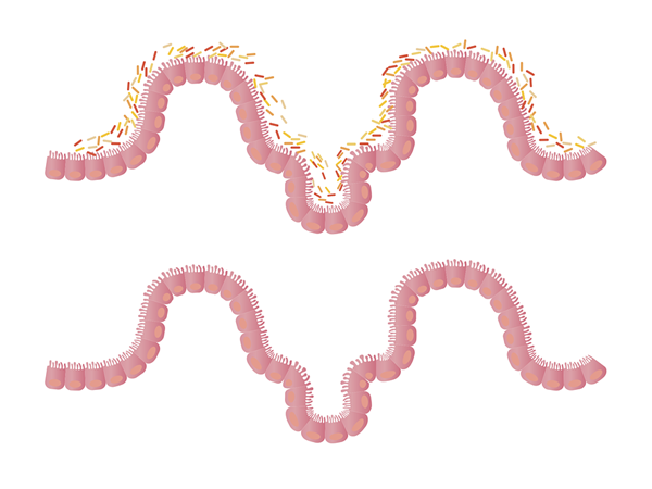 intestino-flora-pixabay